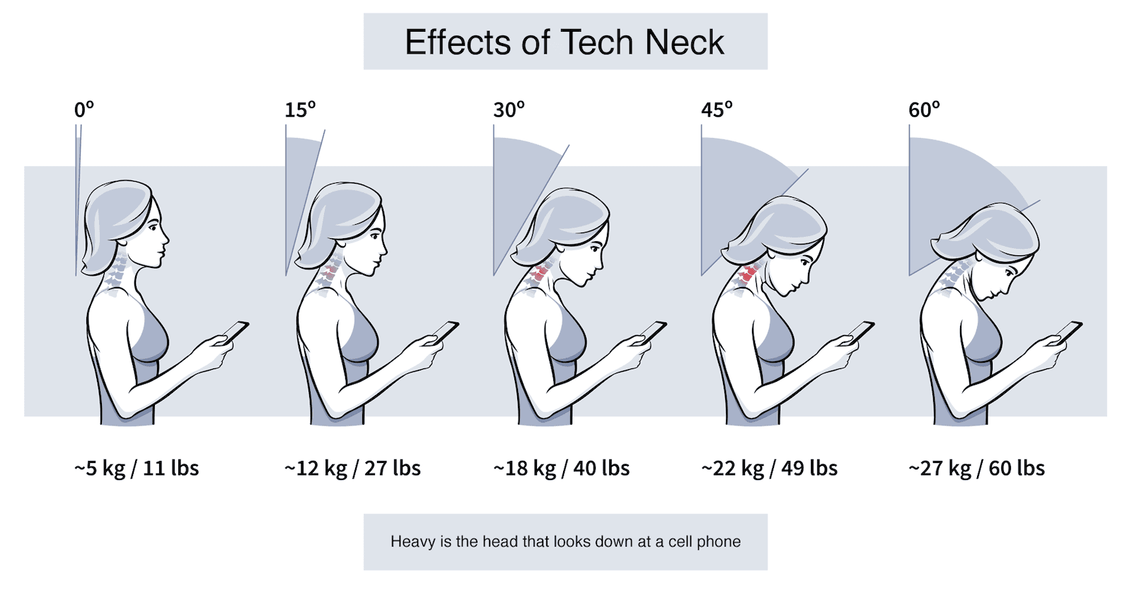 Tech Neck Relief: Mobile Solutions for Modern Problems